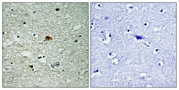 HDAC6 (phospho-Ser22) antibody