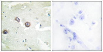 R-cadherin rabbit pAb