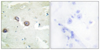 R-cadherin antibody