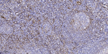 GLCNE rabbit pAb