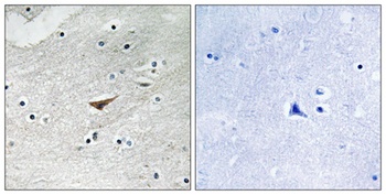 VE-Cadherin (phospho Tyr731) rabbit pAb