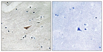 VE-Cadherin (phospho-Tyr731) antibody