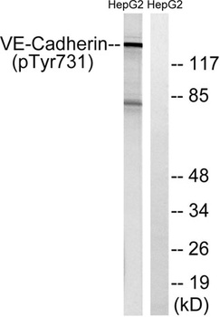 VE-Cadherin (phospho Tyr731) rabbit pAb