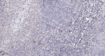 DRP1 (phospho-Ser637) antibody