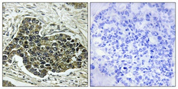 KIF20A antibody