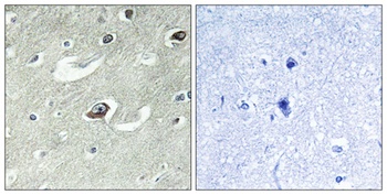 KIF20A antibody