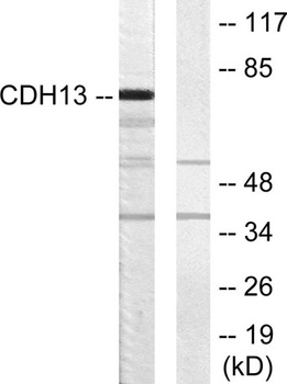 T-cadherin rabbit pAb