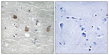 TOB1 (phospho Ser164) rabbit pAb