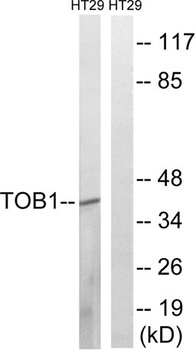 TOB1 antibody