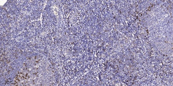 Cadherin-17 antibody