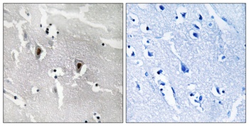 DEF-3 antibody