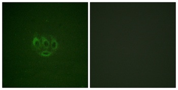 ACK (phospho-Tyr284) antibody