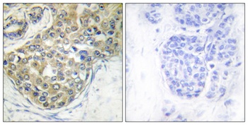 ACK (phospho-Tyr284) antibody