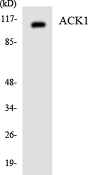 ACK antibody