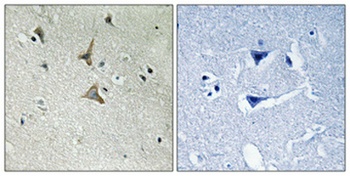 Cdk5 (phospho-Tyr15) antibody