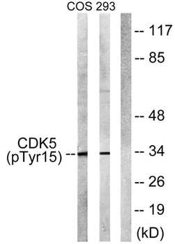 Cdk5 (phospho Tyr15) rabbit pAb