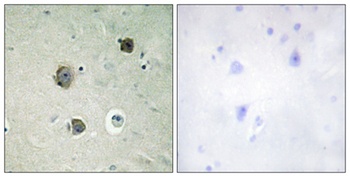 Cdk5 rabbit pAb Antibody