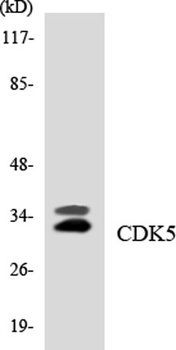 Cdk5 antibody