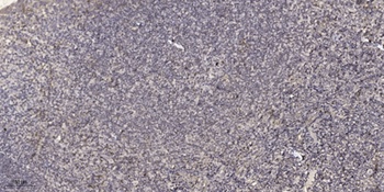 Angptl7 antibody