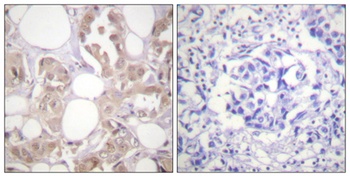 Cdk7 (phospho Thr170) rabbit pAb