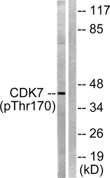 Cdk7 (phospho Thr170) rabbit pAb