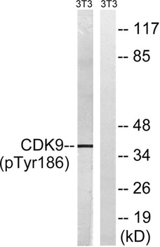 Cdk9 (phospho-Thr186) antibody
