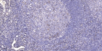 SAP 49 antibody