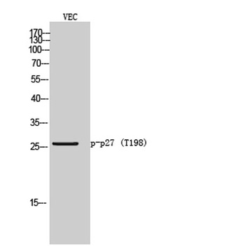 p27 (phospho Thr198) rabbit pAb