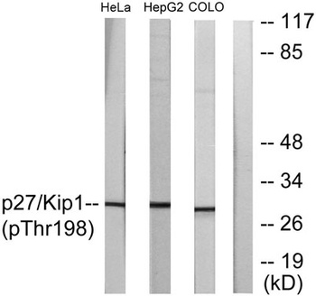 p27 (phospho-Thr198) antibody