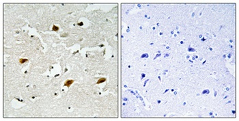 p27 (phospho Thr157) rabbit pAb