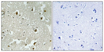 p27 (phospho Ser178) rabbit pAb