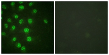 p57 (phospho-Thr310) antibody