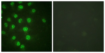 p57 (phospho Thr310) rabbit pAb