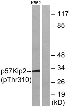 p57 (phospho-Thr310) antibody