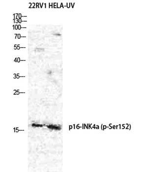 p16 (phospho-Ser326) antibody