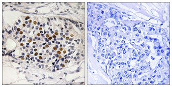 p16 (phospho-Ser326) antibody