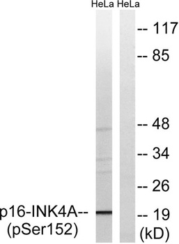 p16 (phospho-Ser326) antibody