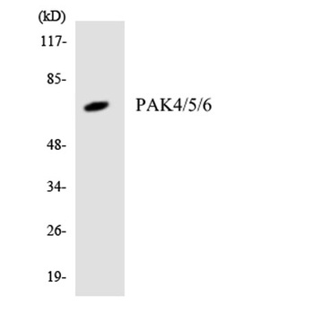 PAK4/5/6 antibody