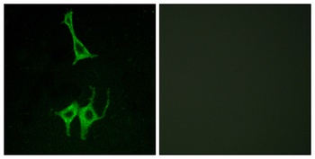 NMUR1 antibody