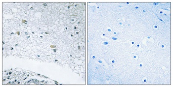 Laminin gamma-3 antibody