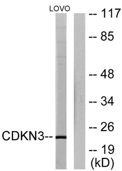 CDKN3 rabbit pAb