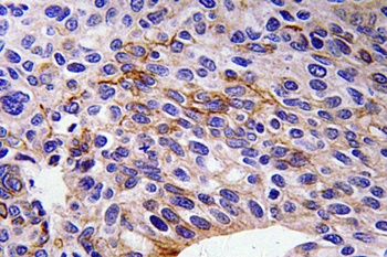 SEMA3A rabbit pAb Antibody