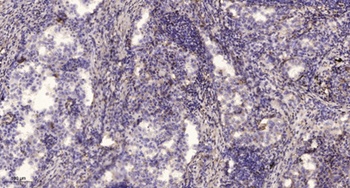 Mindin antibody