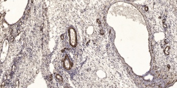 PFAAP5 antibody