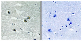 MerTK/Tyro3 (phospho Tyr749/681) rabbit pAb