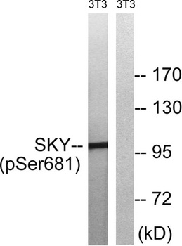 MerTK/Tyro3 (phospho-Tyr749/681) antibody