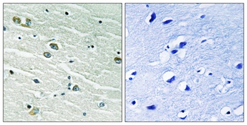 MerTK/Tyro3 antibody