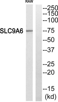 MRSA antibody