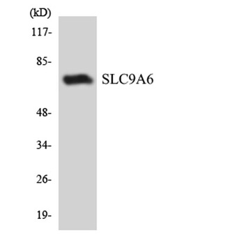 MRSA antibody