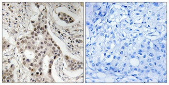 GRIP-1 (phospho Ser736) rabbit pAb